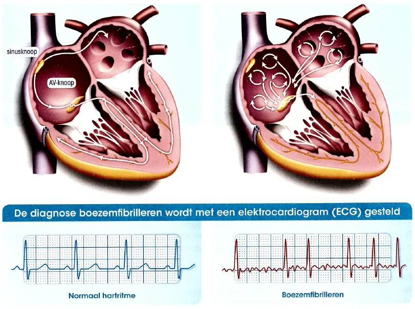 Wetenschappers meten effect van oorclip op hartritme